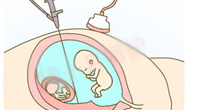 菏泽同父异母半同胞鉴定