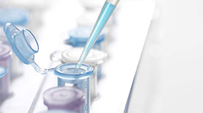 菏泽羊做动物亲子鉴定