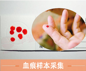 菏泽血痕样本采集方法