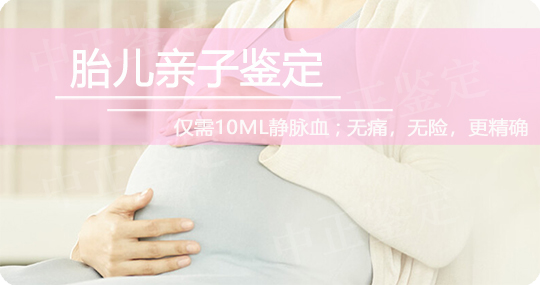 菏泽无创孕期亲子鉴定