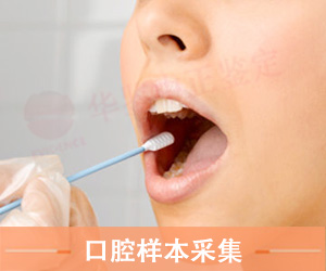 菏泽口腔拭子采集方法