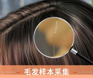 菏泽毛发样本采集方法