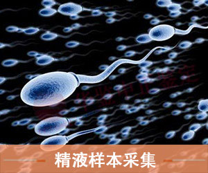 菏泽精液样本采样