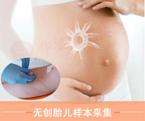 菏泽无创胎儿样本采样