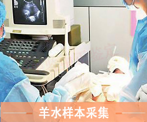 菏泽羊水样本采样方法