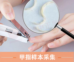 菏泽指甲样本采集方法